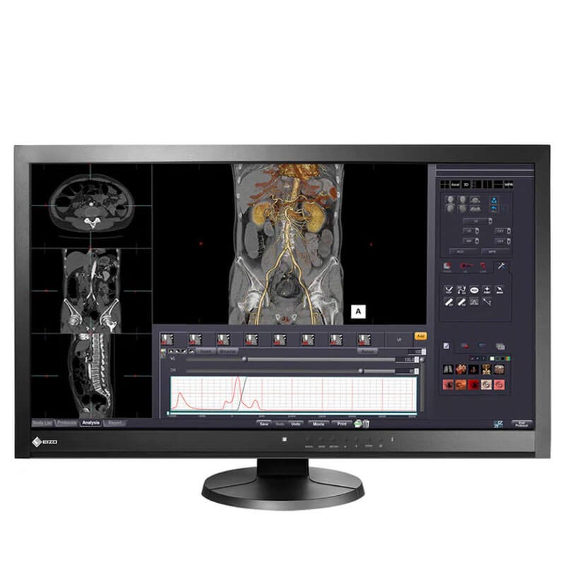 Monitoare LED Eizo RadiForce MX270W, 27 inci 2K, 2560 x 1440p, Panel IPS